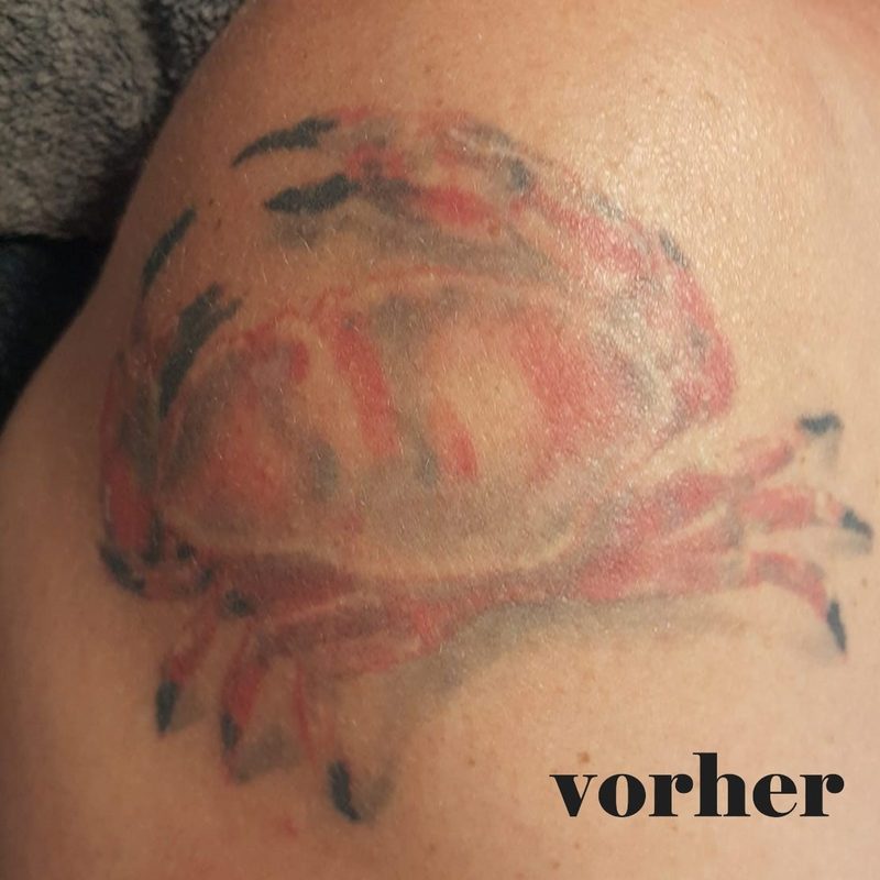 Cover-Up vorher: verwaschener alter Krebs